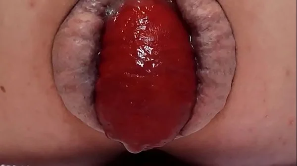 Contender For Biggest Prolapse (Male Warning!) videos