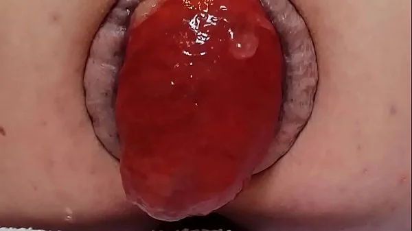 Contender For Biggest Prolapse (Male Warning!) videos