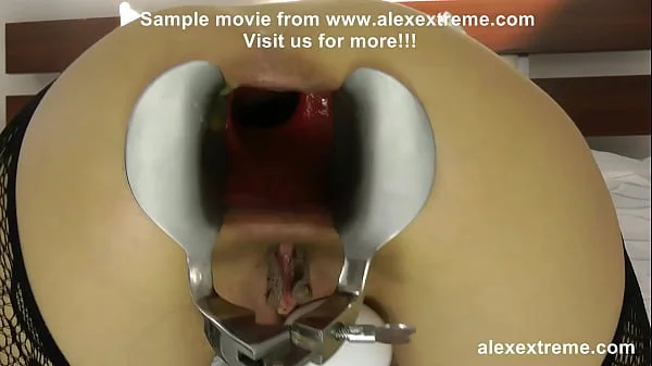 Extreme anal fisting, huge dildos and prolapse compilation from alexextreme 69-89 videos