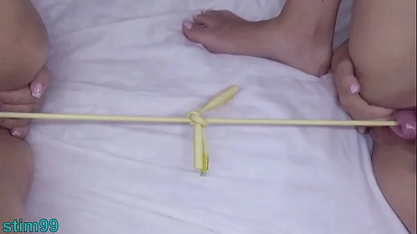 Prolapsed Cervix Lesbians at the same time videos
