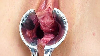 Anabelle Gyno Exam videos